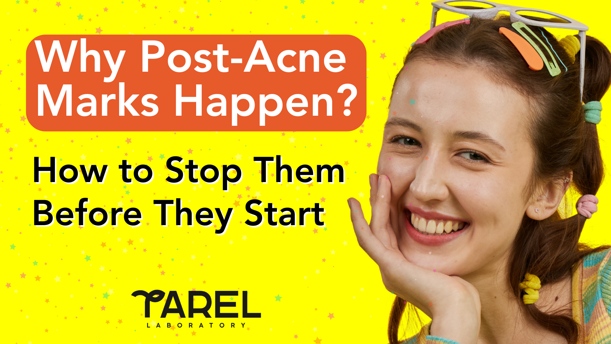 Why Post-Acne Marks Happen (and How to Stop Them Before They Start)